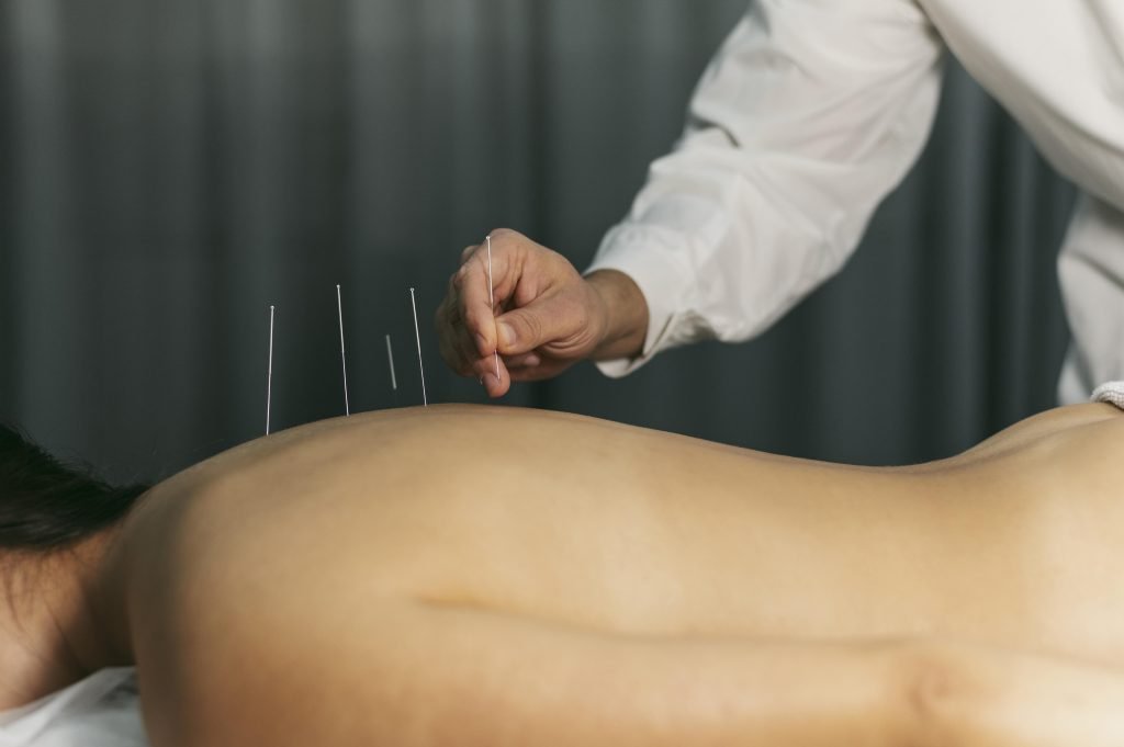 Acupuncturist in Eindhoven